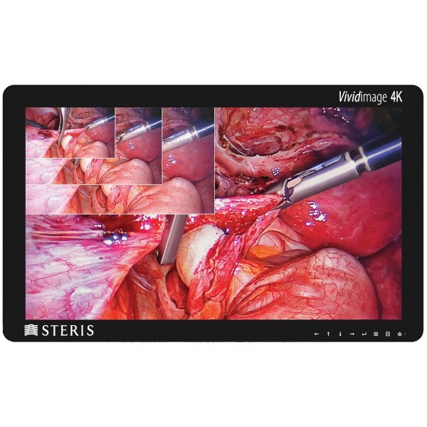 Ecran chirurgical 4K 32" 32HL710S-W - Ecrans 4K HD - Ecrans  chirurgicaux - Ecrans de diagnostic médical - Matériel Imagerie médicale 